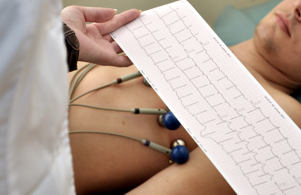 Electrocardiograma