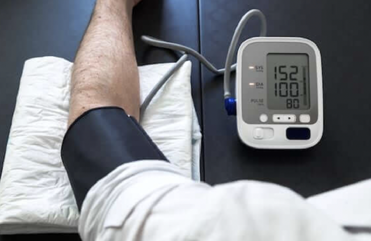 MAPEO de Presión Arterial 